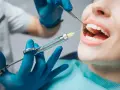 Dentysta podaje znieczulenie, aby ulżyć w bólu. Zastanawiasz się, ile trzyma znieczulenie u dentysty?