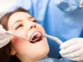 Ropa w dziąśle: Kiedy do dentysty? Objawy i skuteczne leczenie
