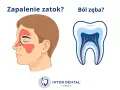 Zapalenie zatok czy ból zęba? Ilustracja pokazuje twarz z zaznaczonymi zatokami i przekrój zęba, sugerując związek między nimi.