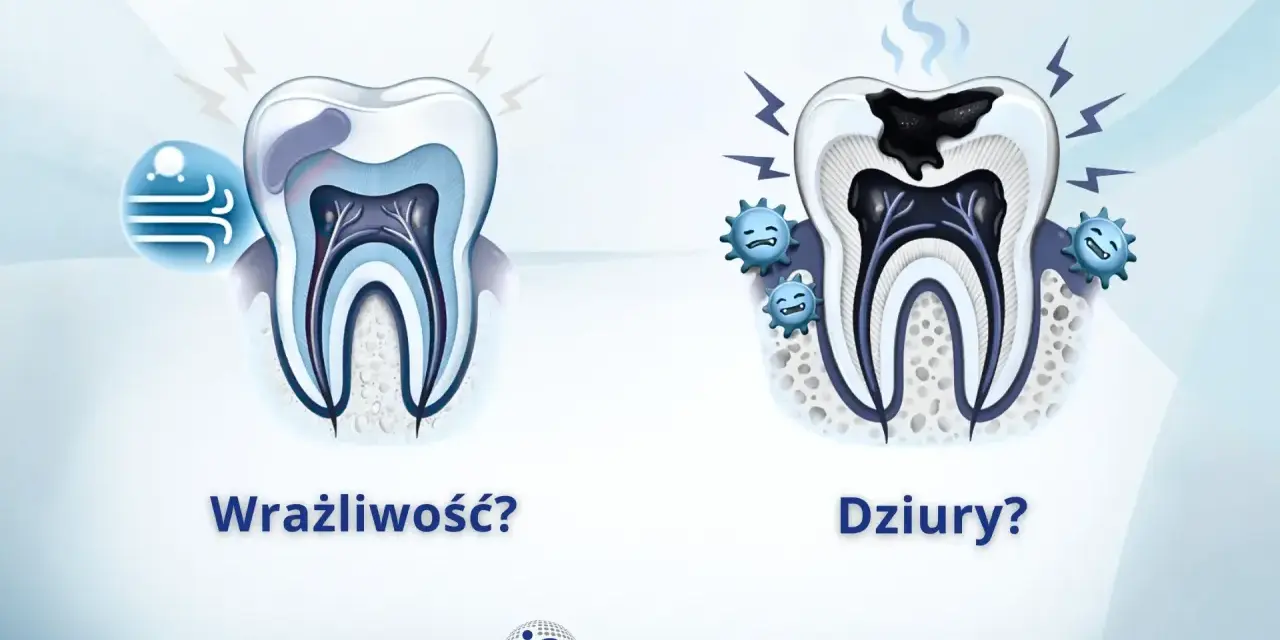 Wrażliwy ząb po lewej, zdrowy po prawej. Po prawej ząb z próchnicą i bakteriami.