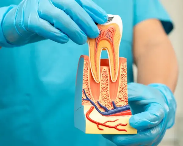 Model zęba w rękach dentysty. Czy ząb po leczeniu kanałowym może się zepsuć? Model pokazuje przekrój zęba z naczyniami krwionośnymi.