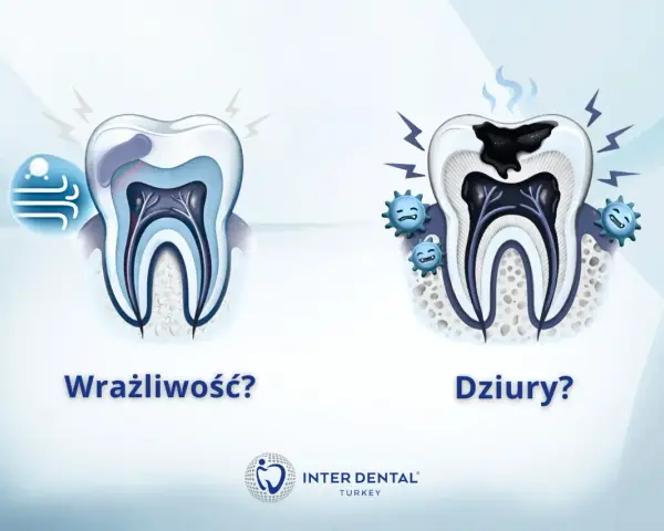 Wrażliwy ząb po lewej, zdrowy po prawej. Po prawej ząb z próchnicą i bakteriami.