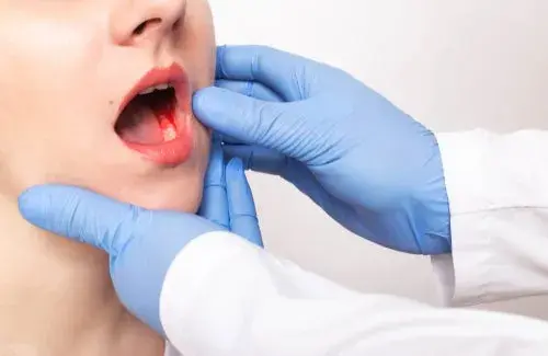 Drętwienie po dentyście: Jak długo potrwa? Wszystko, co musisz wiedzieć