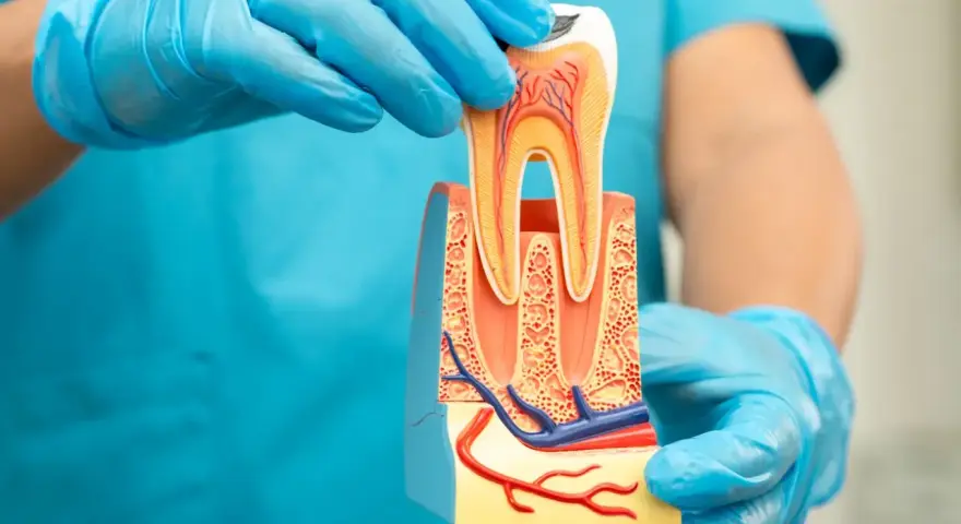 Model zęba w rękach dentysty. Czy ząb po leczeniu kanałowym może się zepsuć? Model pokazuje przekrój zęba z naczyniami krwionośnymi.
