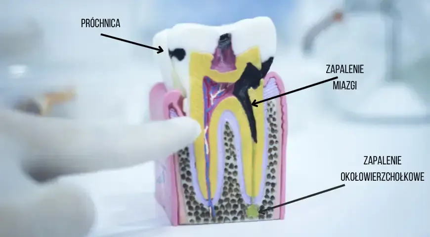 Boli ząb, nie wiesz który? Jak dentysta precyzyjnie znajdzie przyczynę