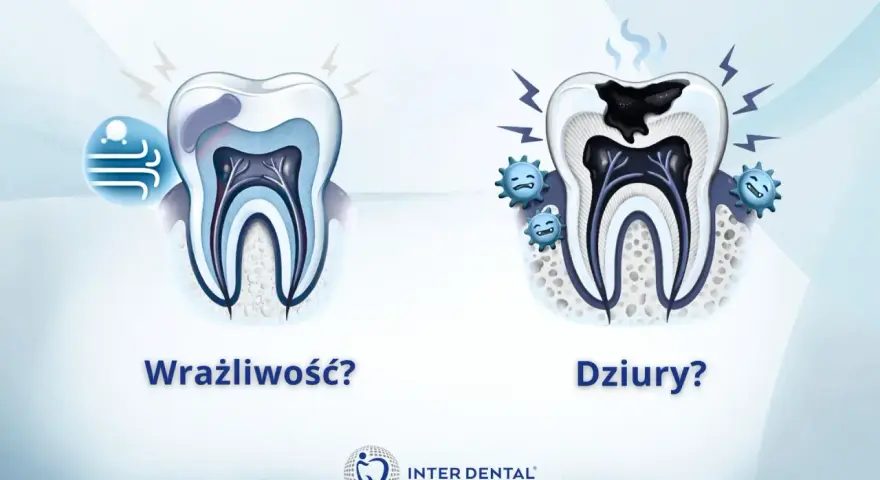 Wrażliwy ząb po lewej, zdrowy po prawej. Po prawej ząb z próchnicą i bakteriami.