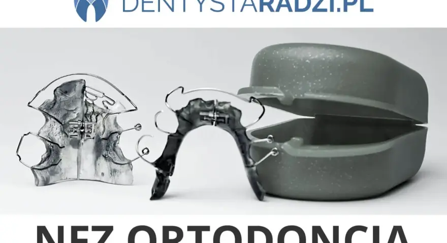 Aparat na zęby: Gdzie założyć? Pełny koszt, typy, NFZ i porady