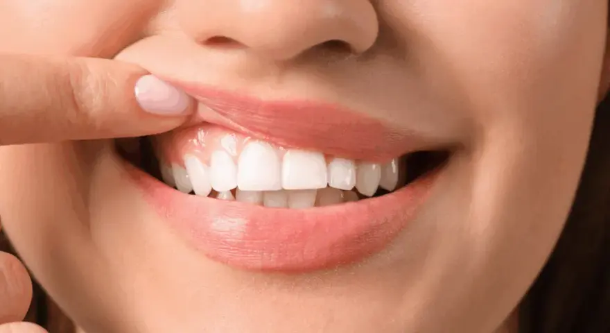 Bolące dziąsła: Jak szybko znaleźć ulgę i kiedy iść do dentysty?